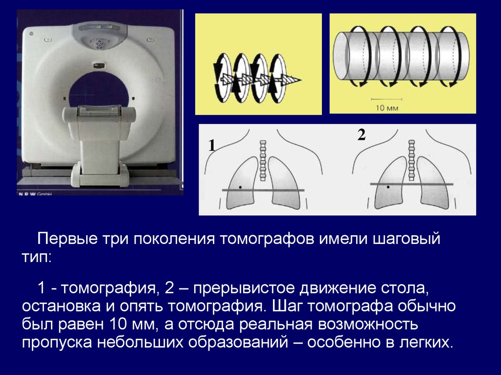 Обработка рентгеновского изображения. Кт сканер 1 поколения. Поколения компьютерных томографов. Компьютерные томографы 1 поколения. Компьютерный томограф 2 поколения.