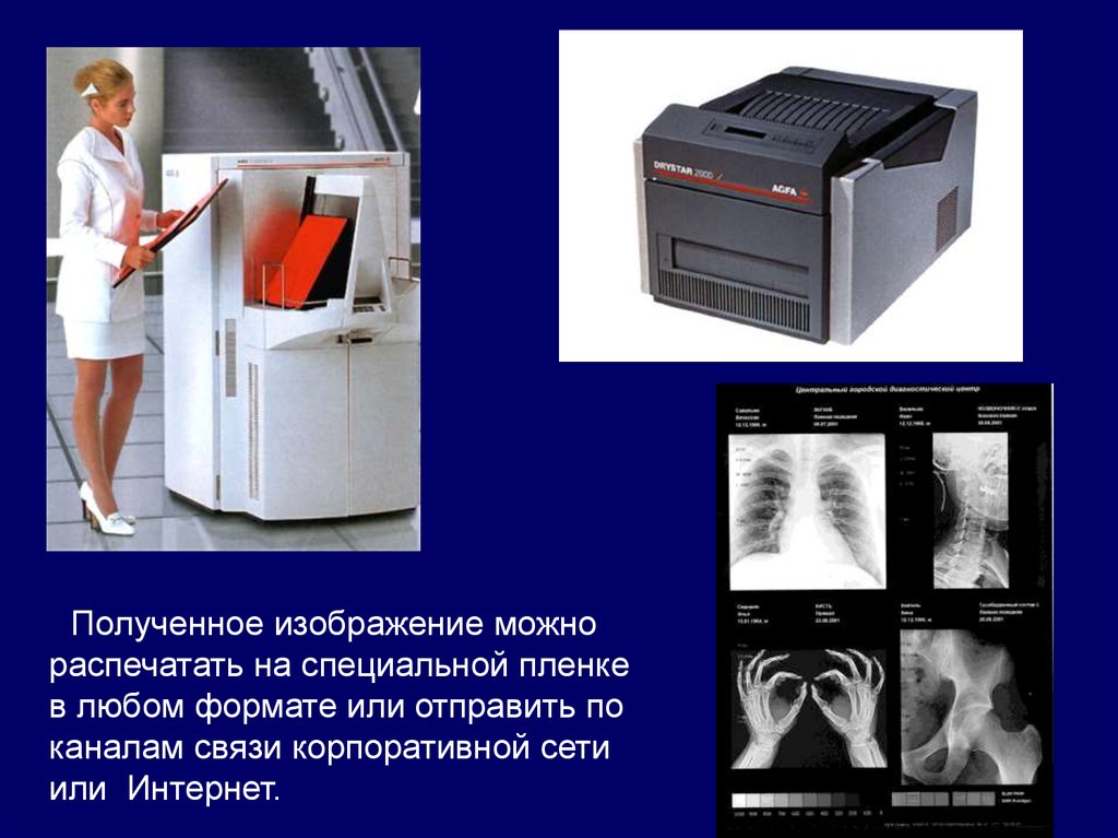 Получение и обработка изображений. Обработка цифровых рентгеновских изображений. Рентгеновские изображения на пленке. Обработка пленки рентген. Изображение получаемое на рентгеновской пленке.