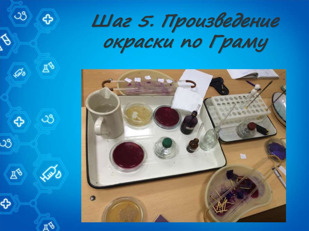 Шаг 5. Произведение окраски по Граму