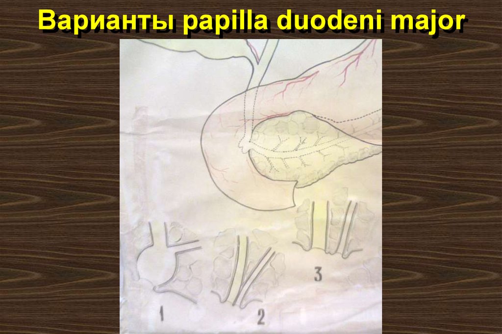 Варианты papilla duodeni major