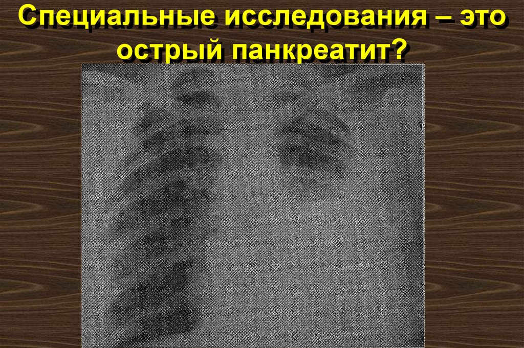 Специальные исследования – это острый панкреатит?