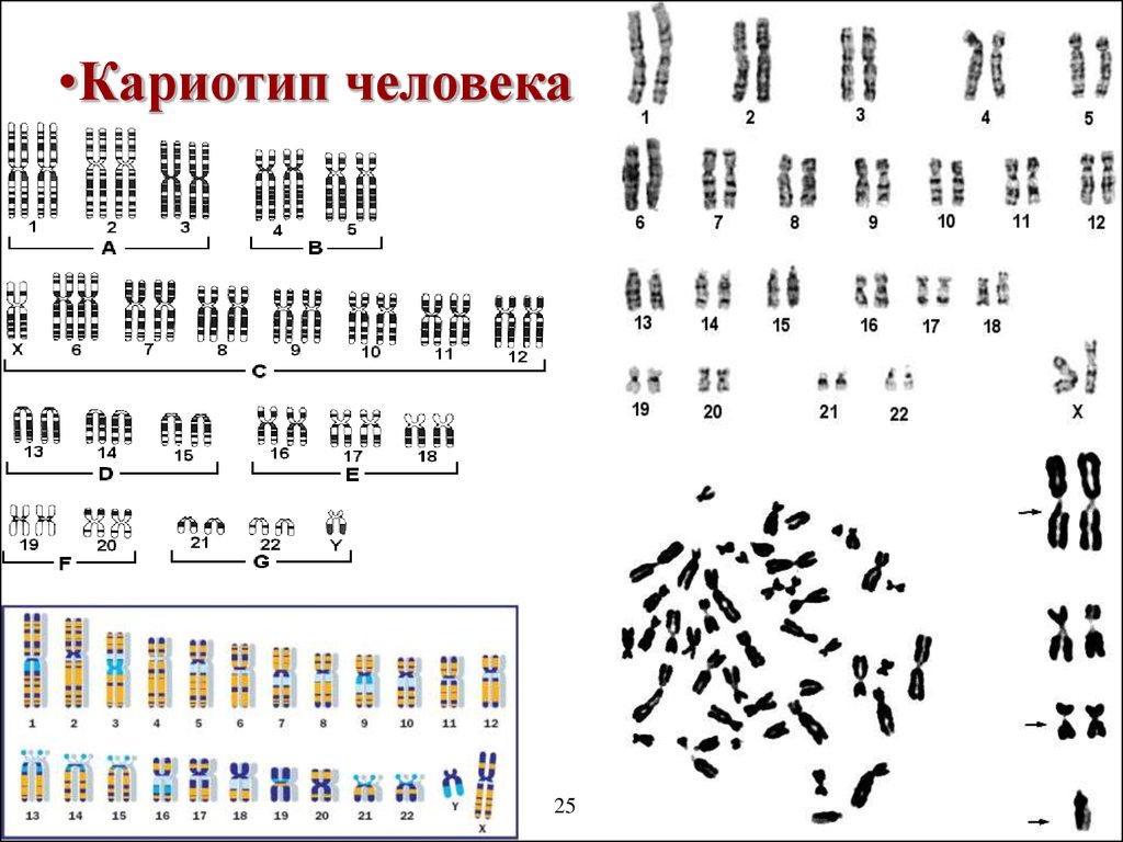 Схема хромосомного набора. Кариотип хромосомный набор. Хромосомный набор клетки кариотип. Кариотип человека хромосомы. Кариотип набор хромосом 2n2c.
