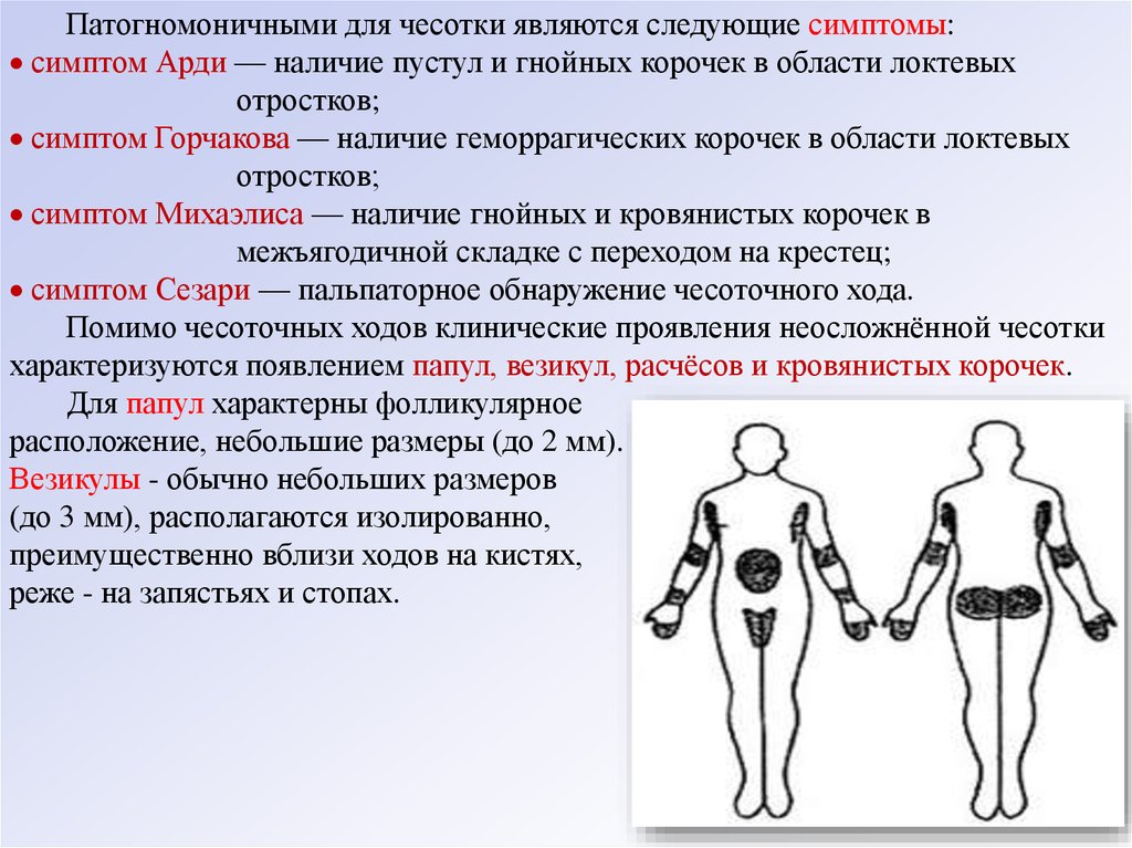 Явиться следующим людям. Симптом Арди Горчакова Михаэлиса. Симптомы чесотки Арди Горчакова. Симптом Горчакова чесотка. Симптом Арди Мещерского.