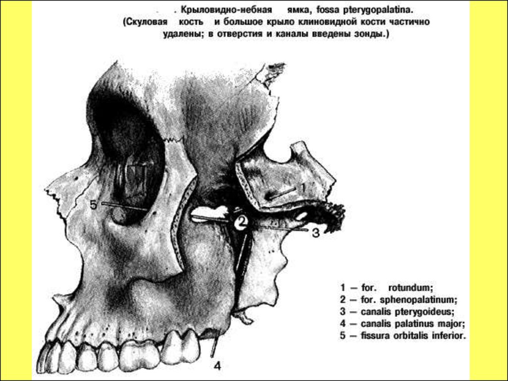 Стенки крылонебной ямки. Крыловидно-небная ямка(Fossa pterygopalatina). Крыловидно-небная ямка на черепе. Крыловидно-небная (крылонебная) ямка. Крыловидно-небная ямка на черепе сообщения.
