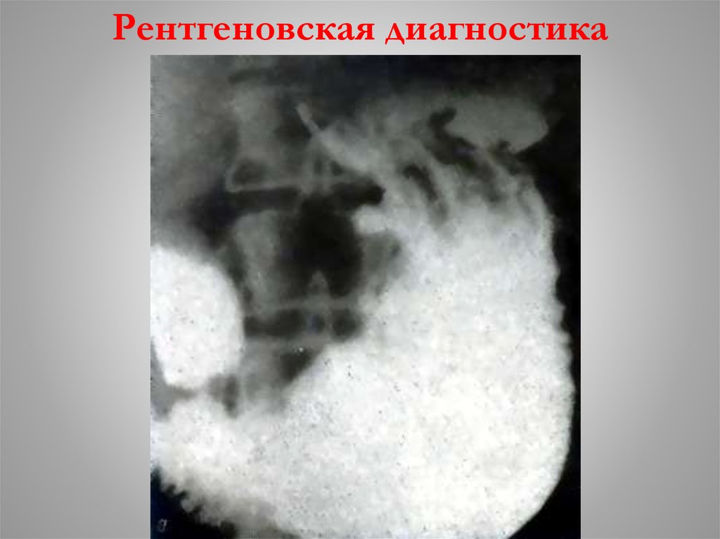 Рентгеновская диагностика