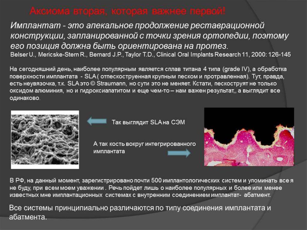 Поверхность имплантатов