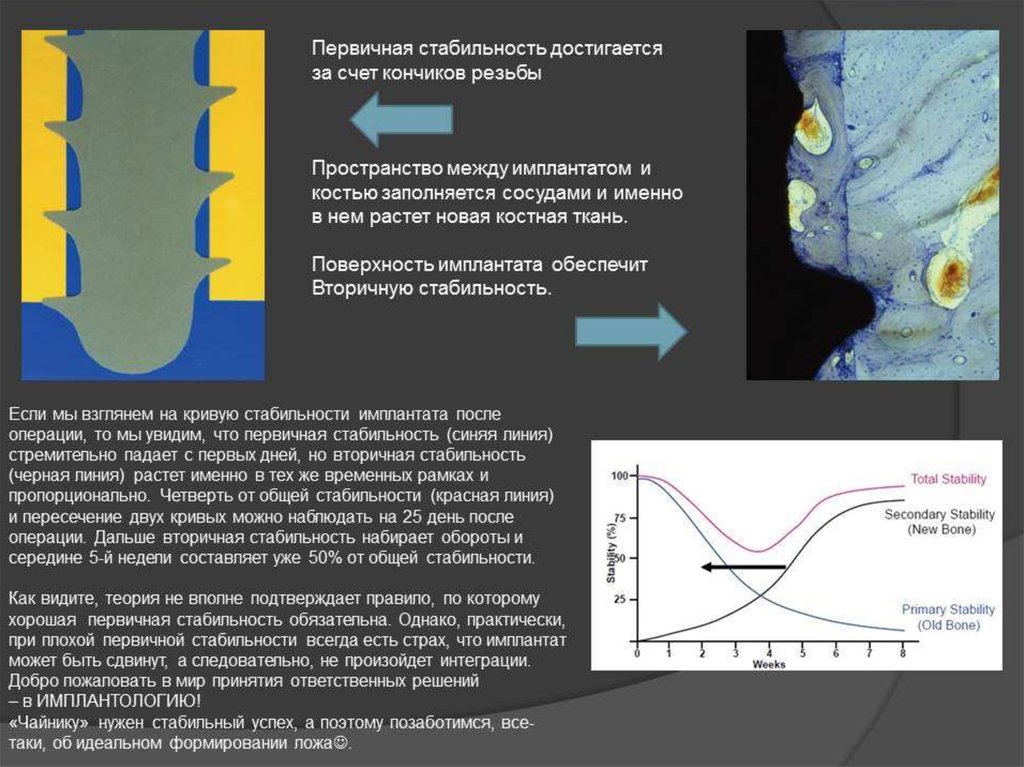 Остеоинтеграция имплантата презентация