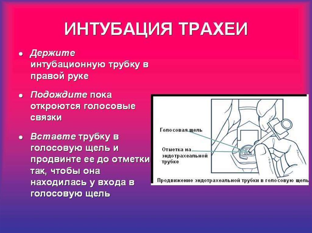 Интубация трахеи презентация