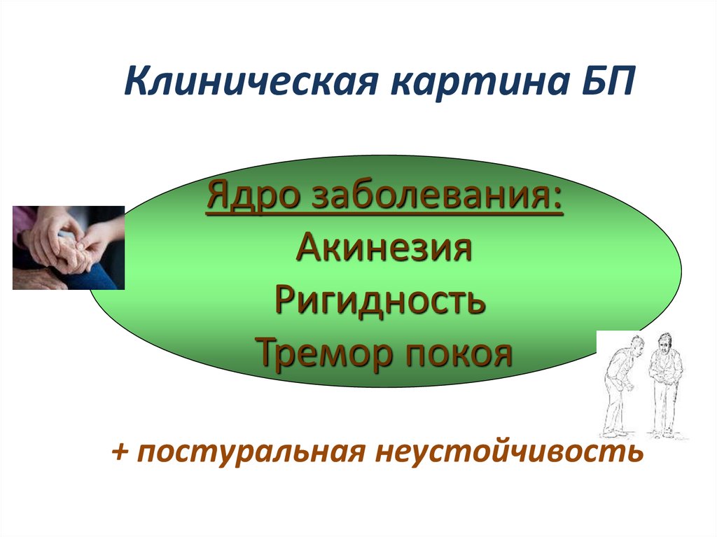 Клиническая картина БП