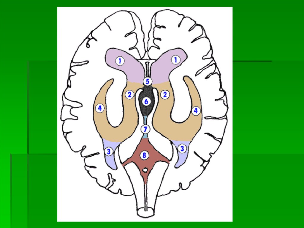 Расширение боковых рогов. Боковые желудочки головного мозга анатомия. Желудочки головного мозга кт анатомия. Топография боковых желудочков мозга. Боковые желудочки анатомия кт.