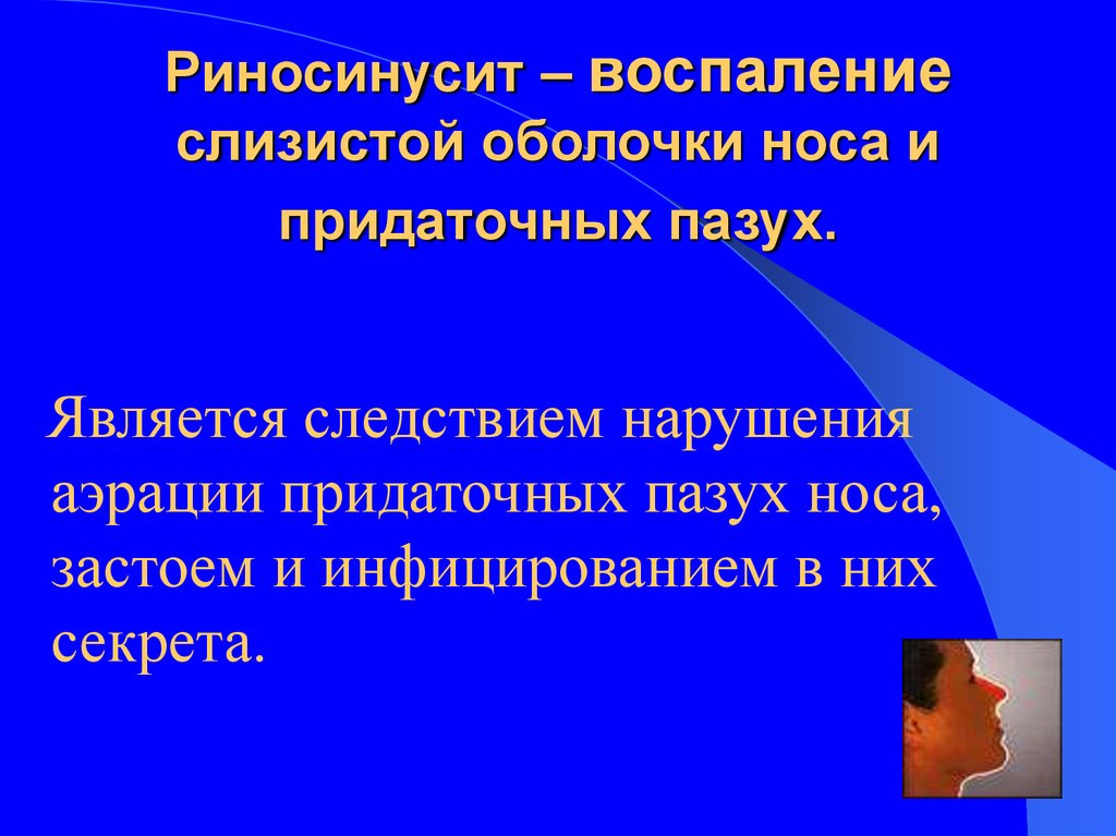 Воспаление слизистой оболочки носа и придаточных пазух. Классификация риносинуситов. Классификация риносинусита. Классификация синуситов.