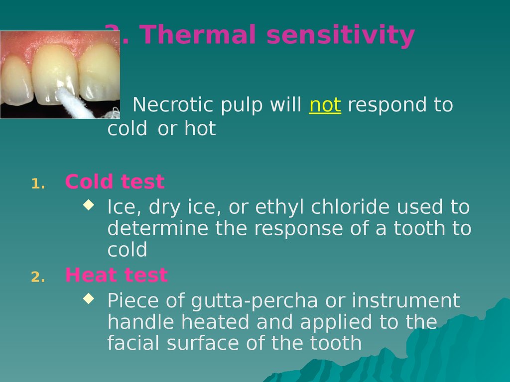 pressure sensitivity test pathogeny etiology,  online Pulpitis classifications and