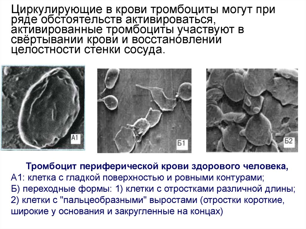 Гранулы тромбоцитов содержат. Активированные тромбоциты. Тромбоциты старые формы. Тромбоциты активированные и неактивированные. Активация тромбоцитов.