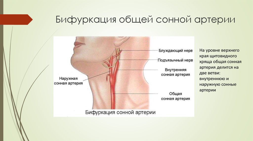 Общая сонная артерия картинки