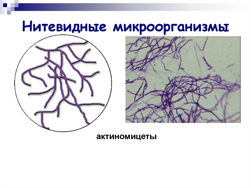 Нитевидные микроорганизмы
