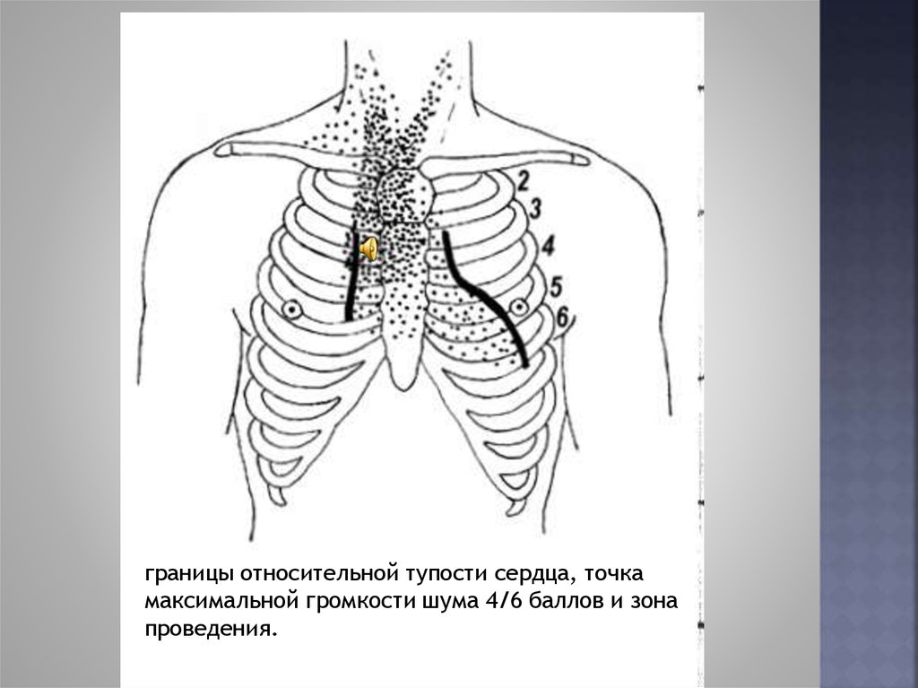 Площадь отверстия аортального клапана