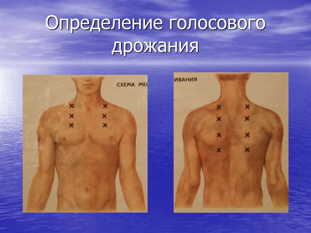 Голосовое дрожание. Определениеголосоого дрожания. Определение голосового дрожания. Определение голосоаого тродания. Определение голоового жрожания.