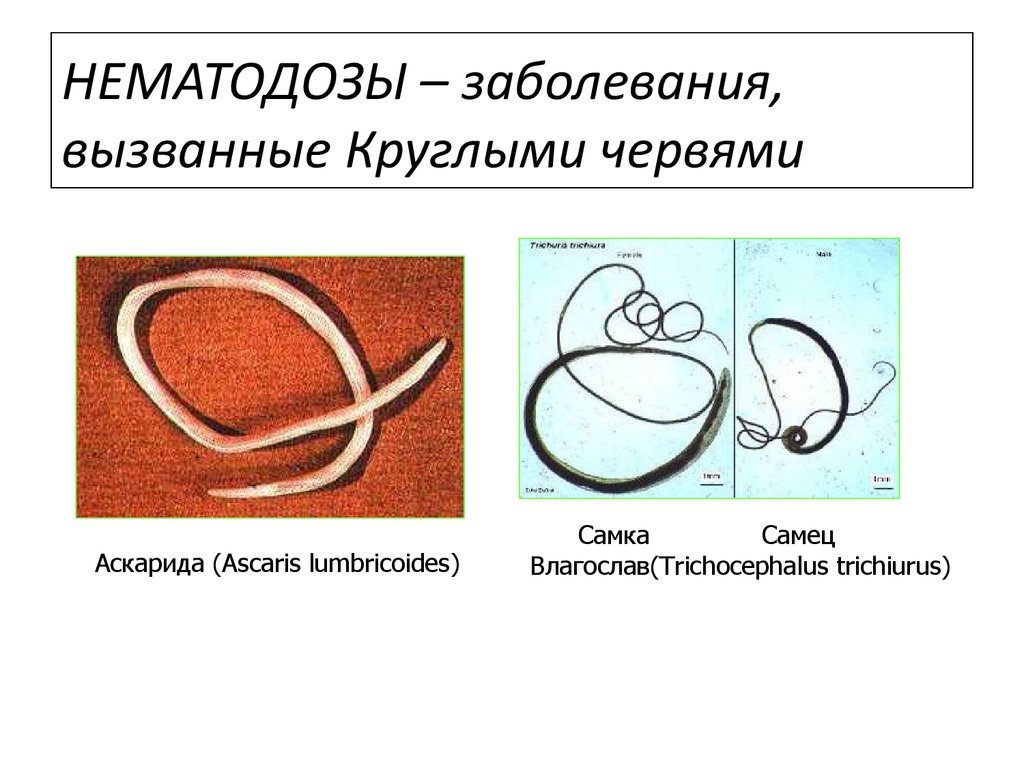 Круглые черви заболевания. Нематодозы (круглые черви).. Заболевания вызванные круглыми червями. Нематодозы заболевания вызываемые.