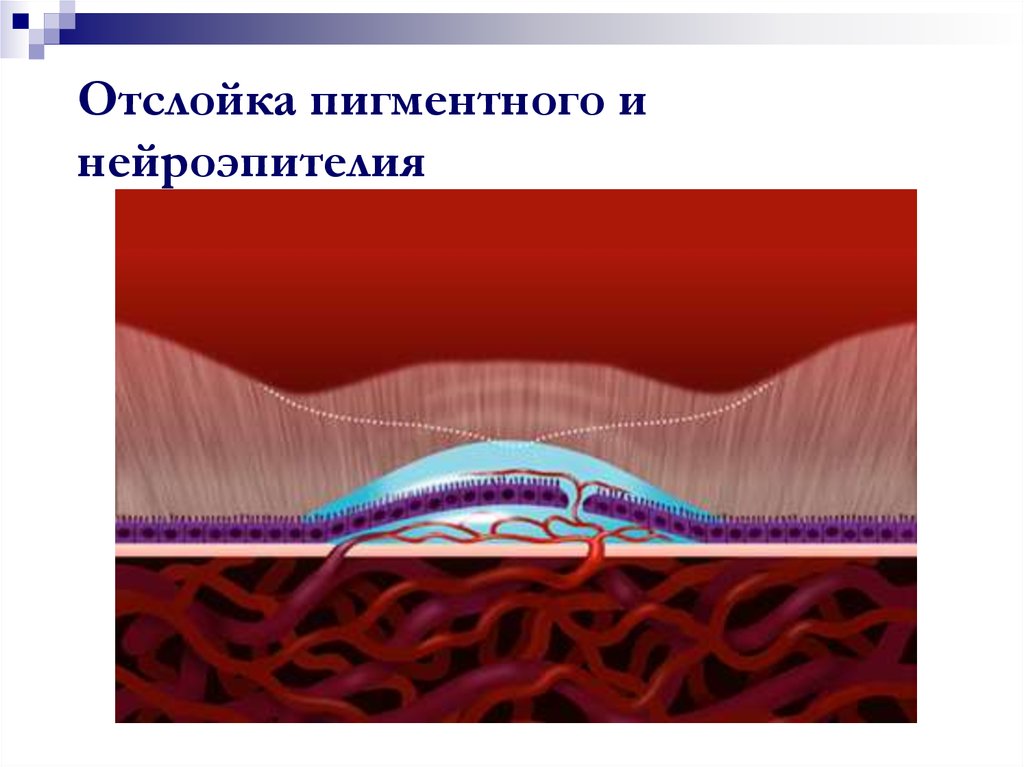 На рисунке пигментного эпителия сетчатки изображены гранулы меланина расположенные