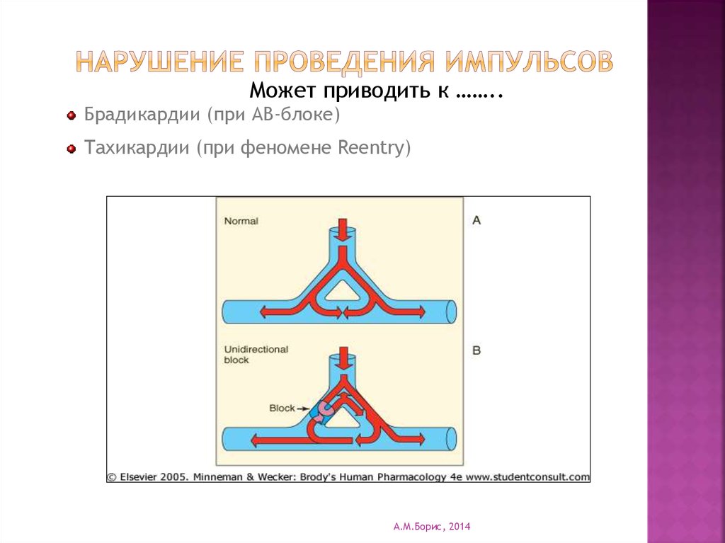 Нарушение проведения. Нарушение проведения импульса. Ретрограднле проведение Импульс. Нарушения проведения импульса классификация. К нарушениям проведения импульса относятся:.