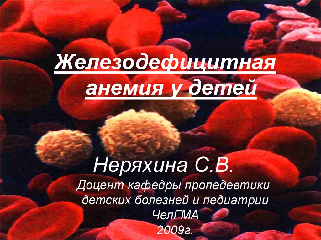 Реферат: Железодефицитная анемия у детей