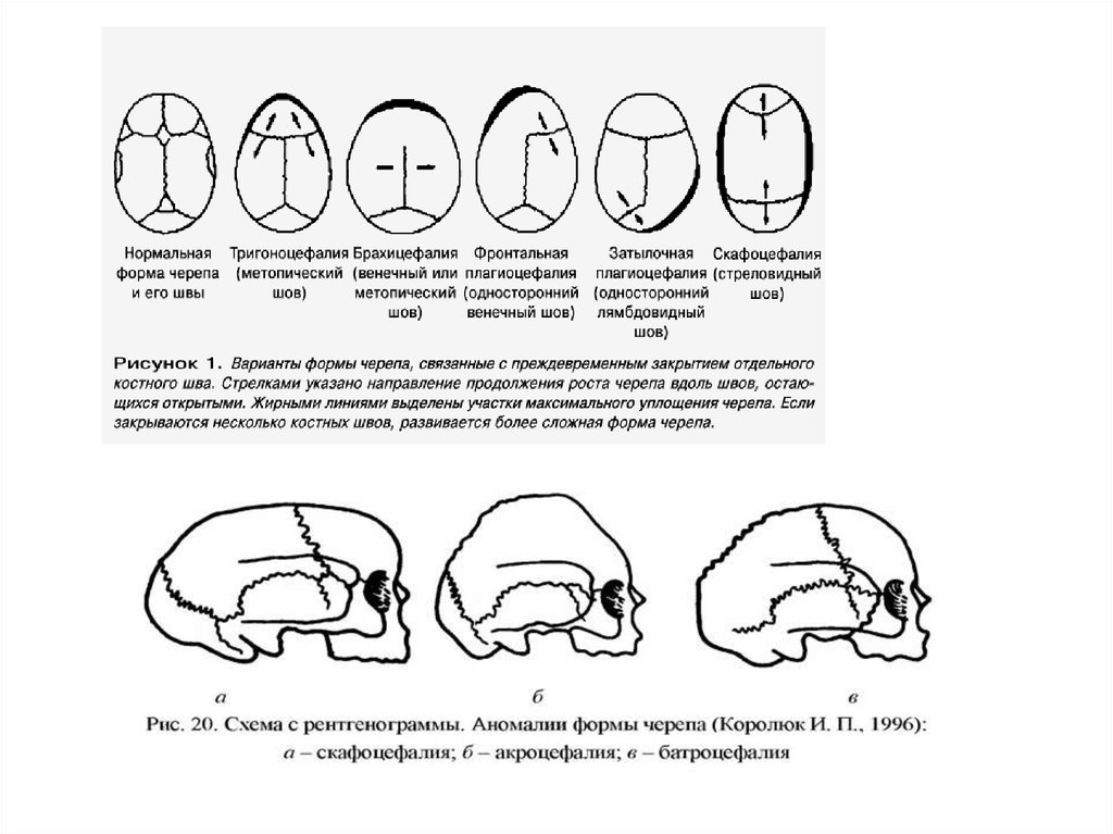 О чем говорят формы черепа. Виды черепов человека классификация. Формы черепа человека. Нормальная форма черепа человека. Виды форм черепа.