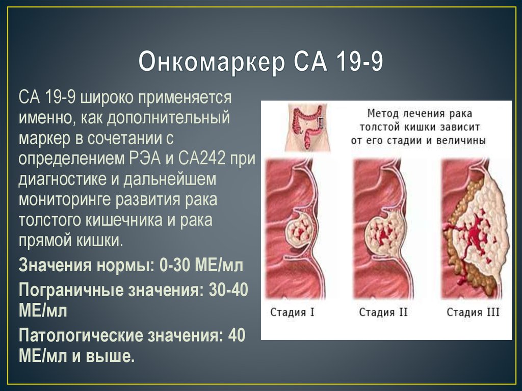 Са 19 9 результат. Маркеры опухоли кишечника. Онкомаркеры кишечника и прямой кишки. Са-19-9 онкомаркер. Онкомаркеры показатели.