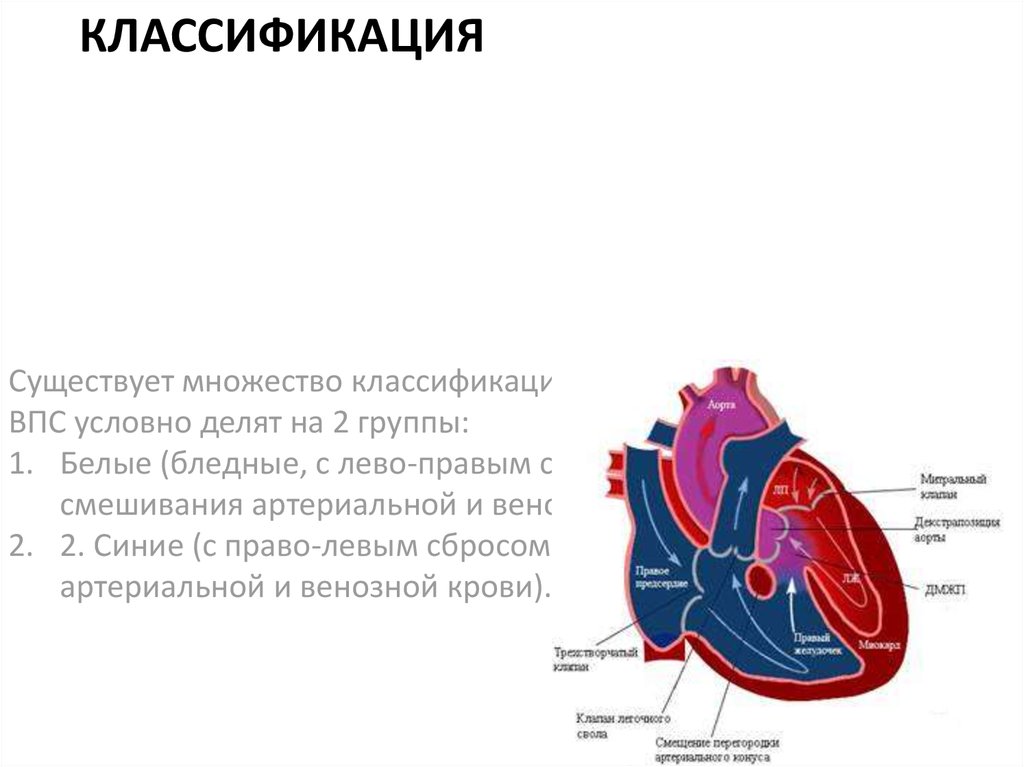 Лево право сброс. Синие врожденные пороки сердца. Бледные врожденные пороки сердца. Лево правый сброс. Пороки с лево-правым сбросом.