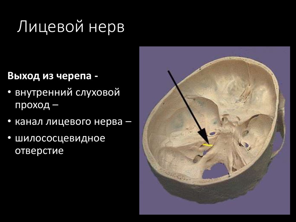 Лицевой нерв череп. Выход лицевого нерва из черепа. Лицевой нерв во внутреннем слуховом проходе. Внутренний слуховой проход анатомия на череп. Лицевой нерв височная кость.
