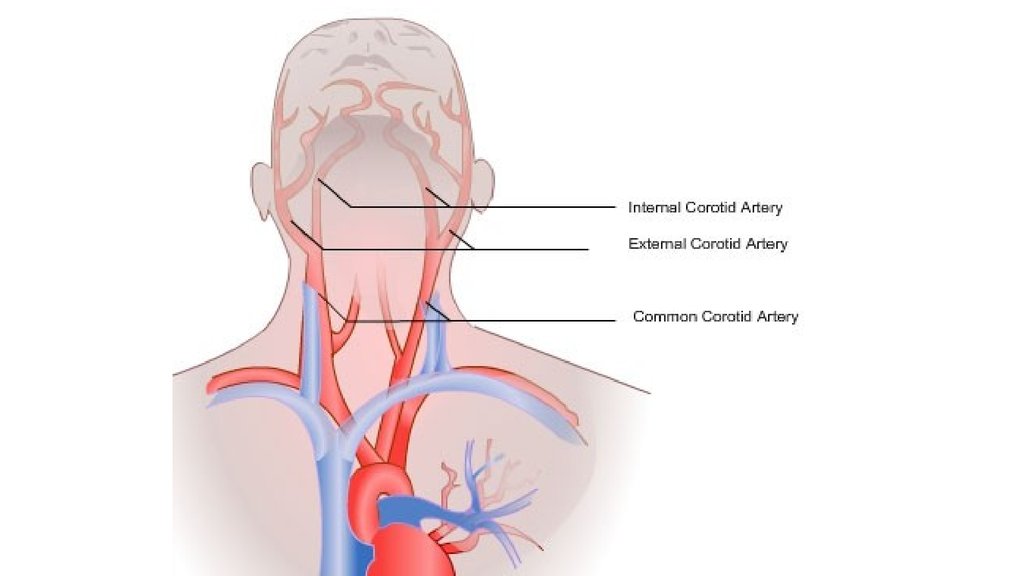 Сонные артерии на шее человека фото. Сонная артерия где находится. Где находится Сонная артерия у человека. Сонные артерии на шее фото.