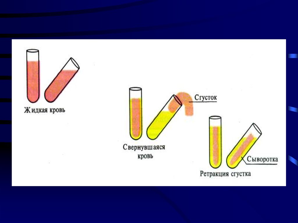 Сывороткой крови называется. Метод получения сыворотки крови. Отличие плазмы от сыворотки крови. Отличия плазмы и сыворотки крови биохимия. Методы получения плазмы и сыворотки крови.