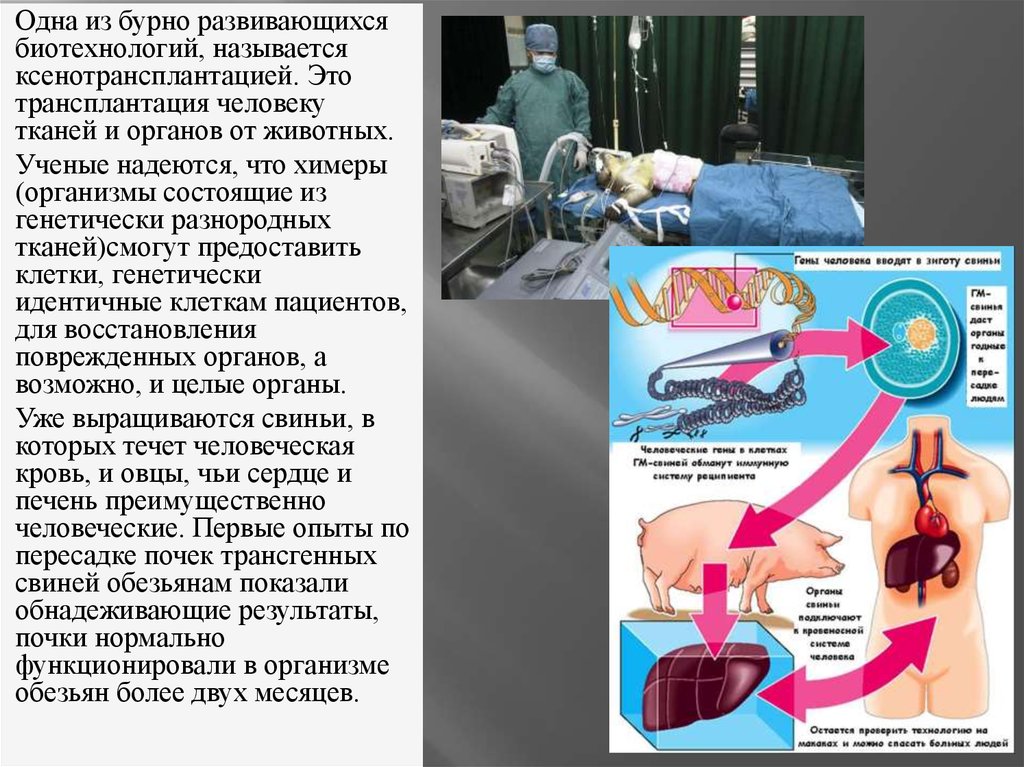 Трансплантации тканей. Трансплантация органов и тканей человека. Трансплантацией (пересадкой) органов и тканей человека. Процесс пересадки органов и тканей. Реанимация и трансплантация органов и тканей.