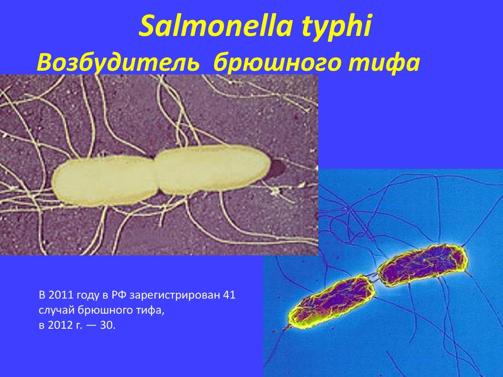 Возбудители бактериальных. Тиф бактерия возбудитель. Возбудитель брюшного тифа микробиология. Вид возбудителя брюшного тифа. Брюшной тиф строение бактерии.