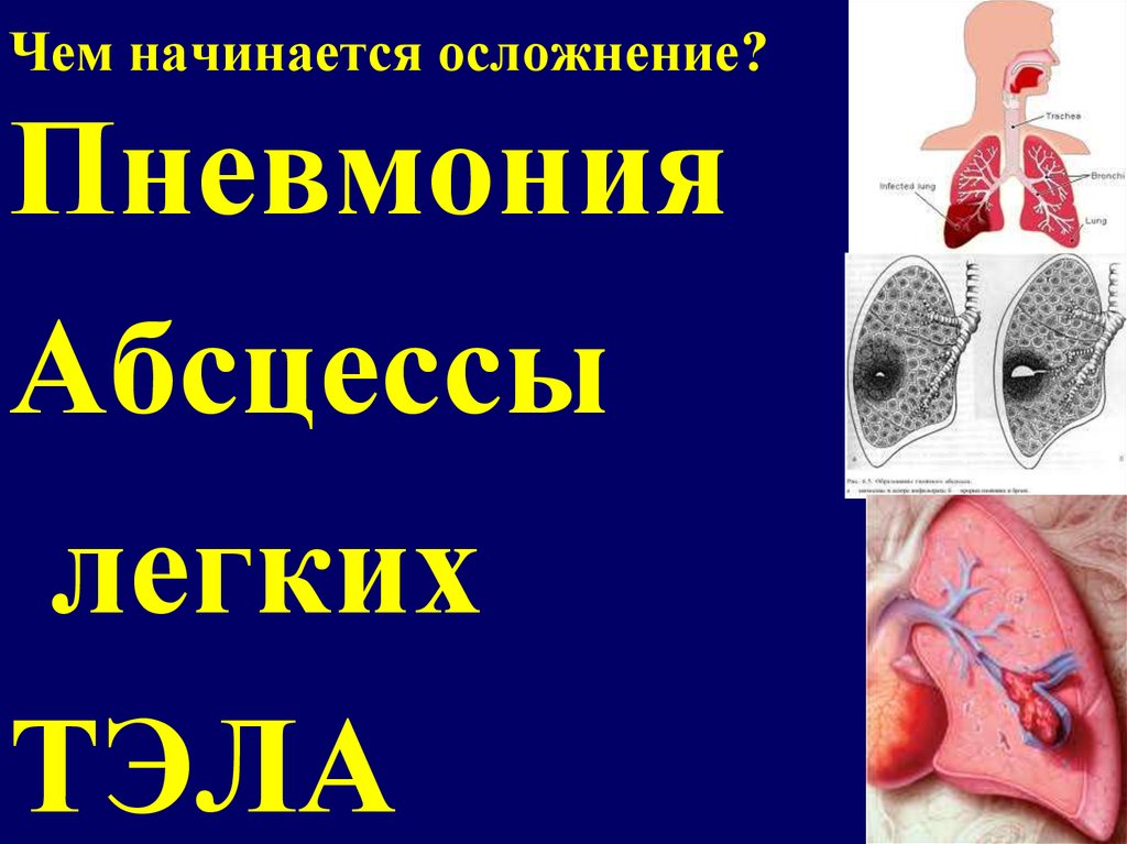 Чем начинается осложнение?