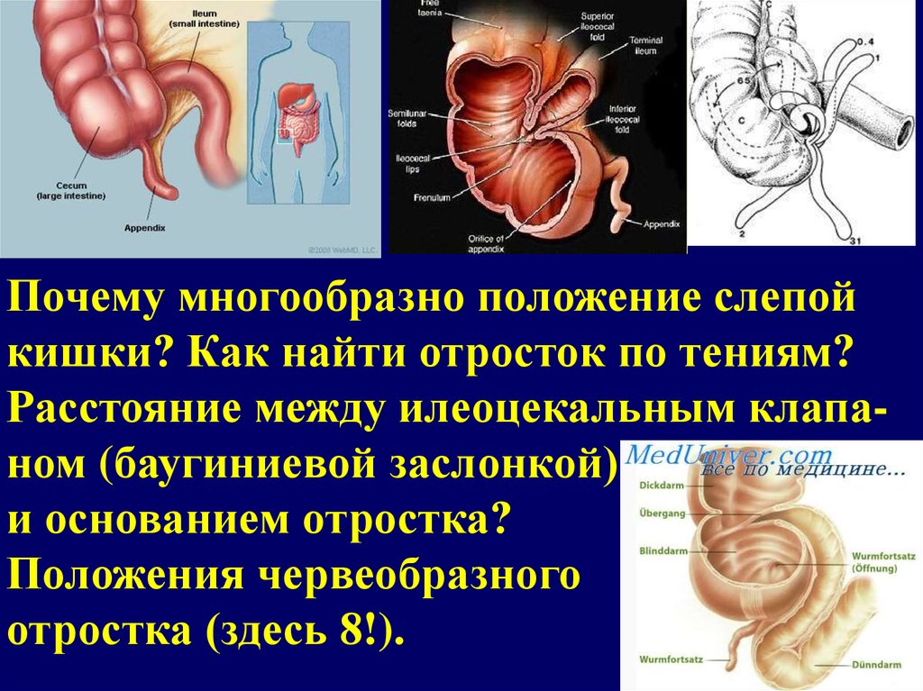 Кишечник слепая кишка где находится