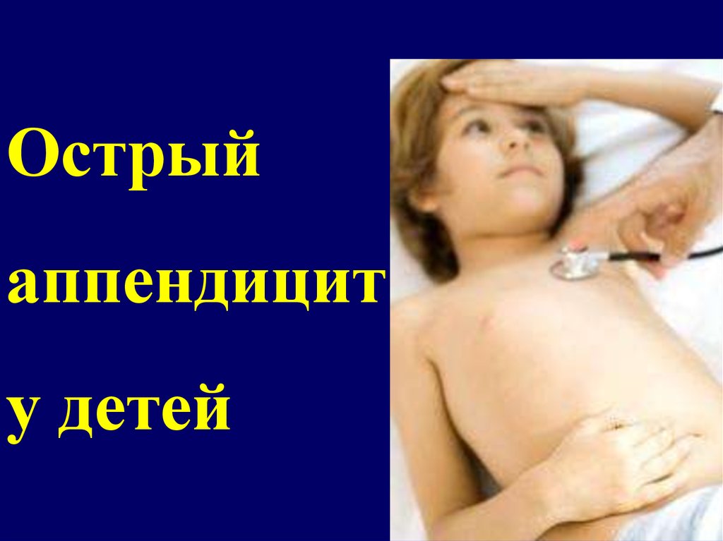 Острый аппендицит у детей