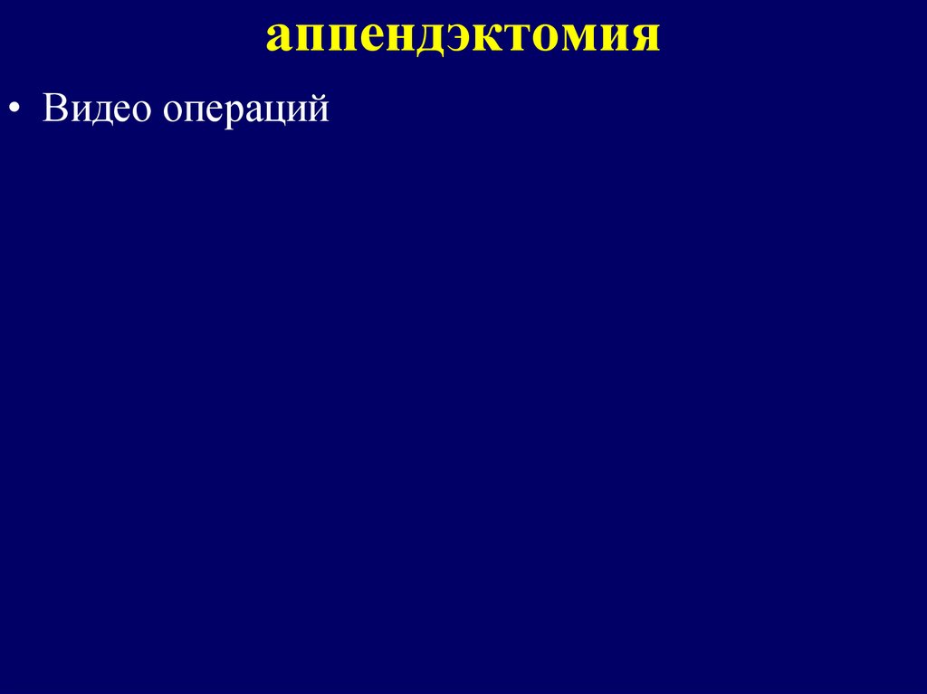 аппендэктомия