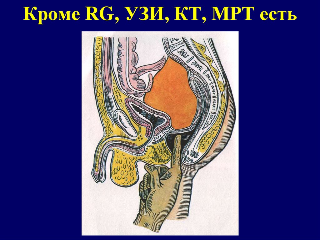 Кроме RG, УЗИ, КТ, МРТ есть