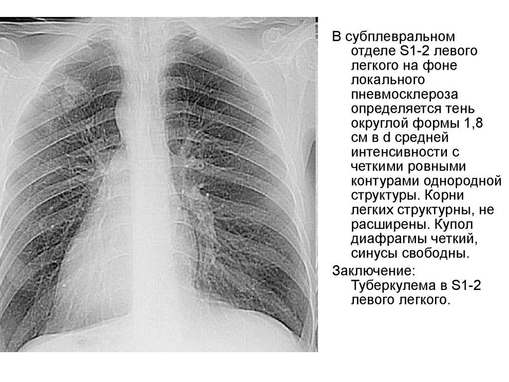 Усилен рисунок корни тяжистые