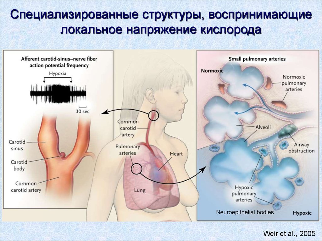 Презентация на тему гипоксия