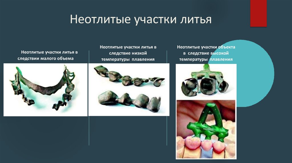 Литейное дело в стоматологии презентация