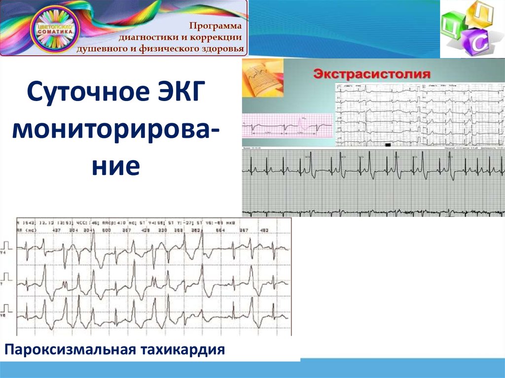 Экг спб