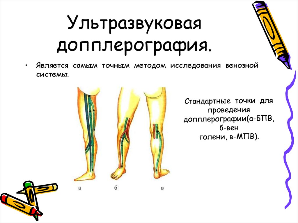 Исследование конечностей. Исследование венозной системы. Методы исследования конечностей. Методы исследования при варикозной болезни нижних конечностей. Методы исследования венозная это-.