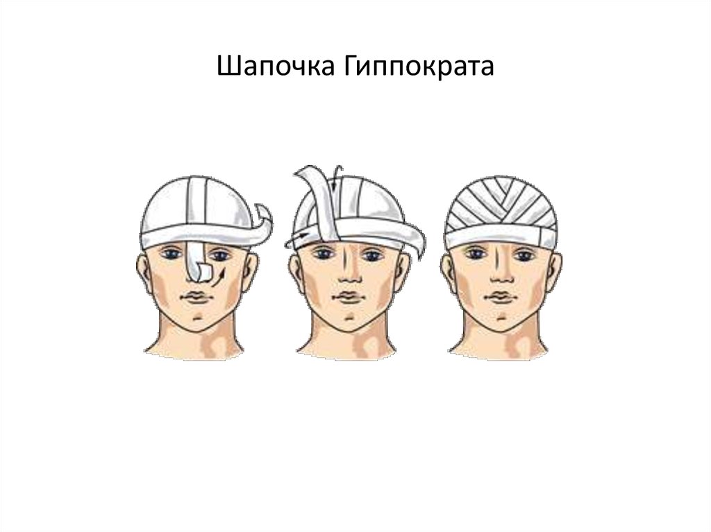 Шапочка гиппократа презентация