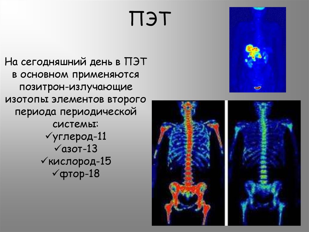 Пэт кт является изображением