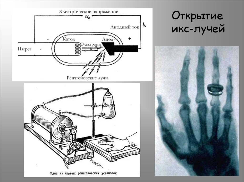 В каких случаях показана компьютерная рентгеновская томография пораженного сустава тест