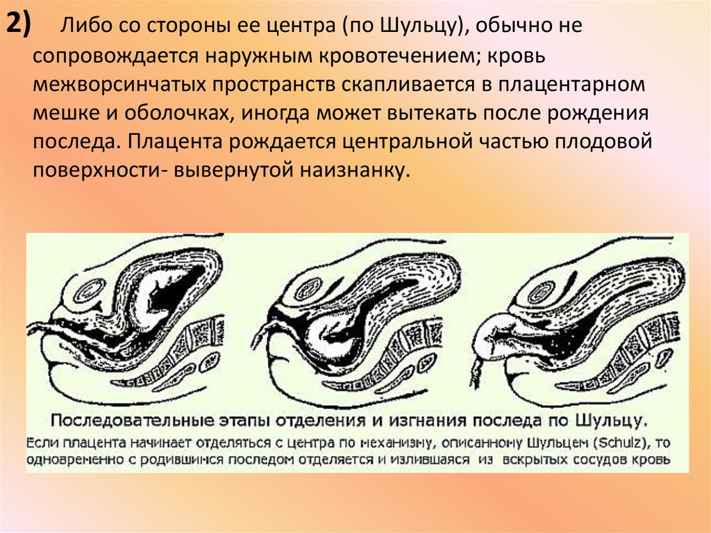 Вывернутая матка на изнанку фото, сайты трамплинг каблуками