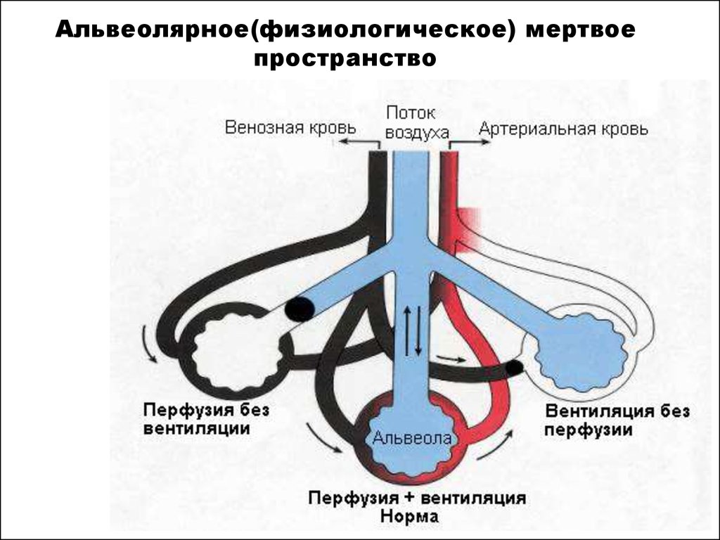 Мертвое пространство. Альвеолярная вентиляция легких схема. Альвеолярное Мертвое пространство. Физиологическое Мертвое пространство. Анатомическое Мертвое пространство.