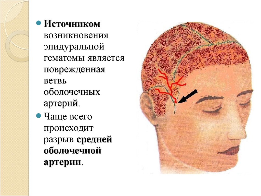 Причины чмт картинки