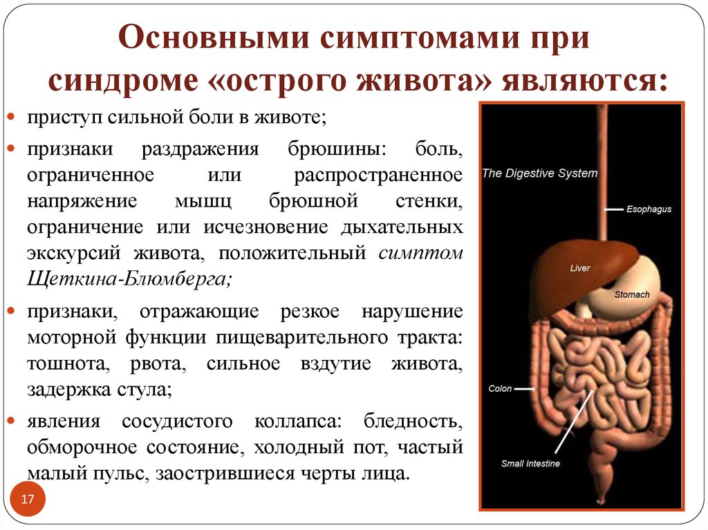 Синдром острого живота презентация